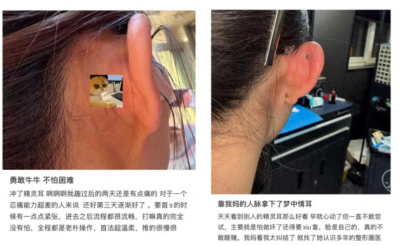 “小脸神器”乱象:“精灵耳”医美女子曝生不如死