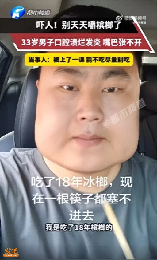 湖北33岁男子吃了18年槟榔 成了方块脸 口腔溃烂