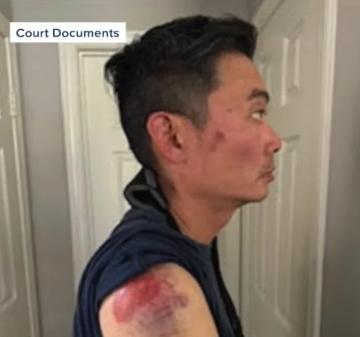 华人男子Costco外遭种族辱骂被摔晕 还被反咬袭警
