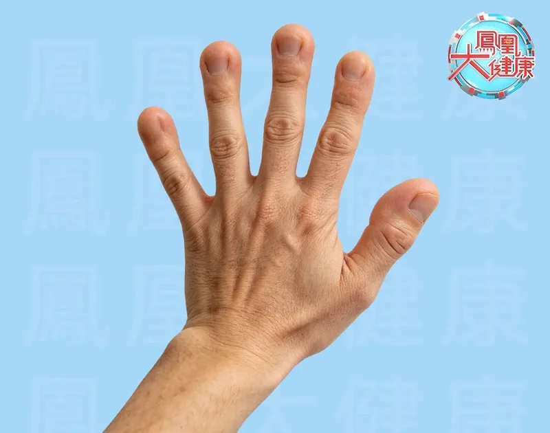 手指出现这种改变 癌症风险极高