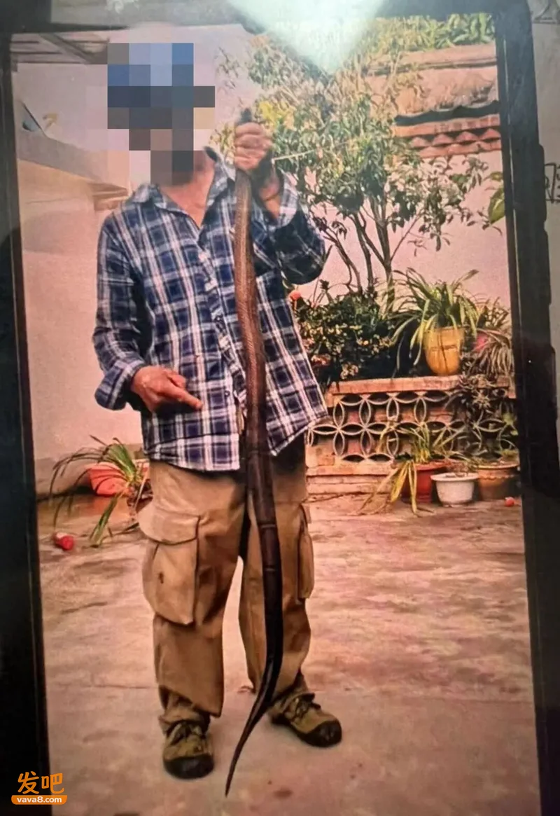 "再也不敢了!"云南男子徒手抓蛇被咬后淡定合影 抢救4次才保命