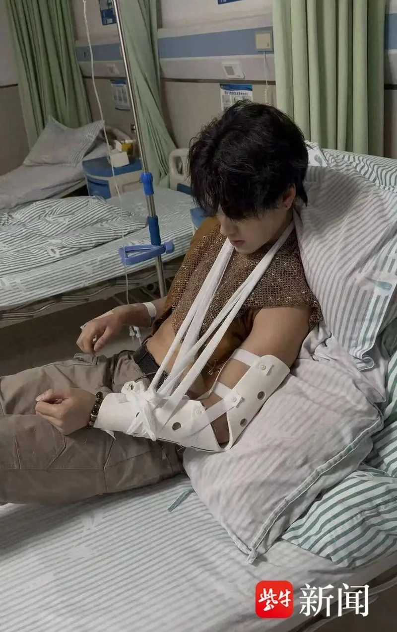一级运动员当景区NPC 掰手腕遭游客掰断手臂