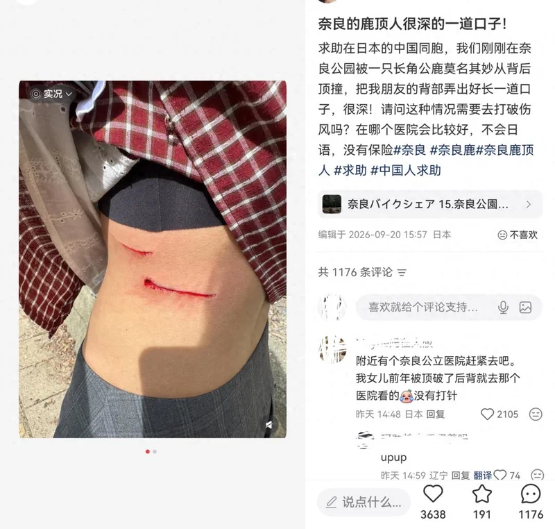 中国游客在日本奈良喂鹿遭公鹿从背后袭击 背部被顶出深长伤口