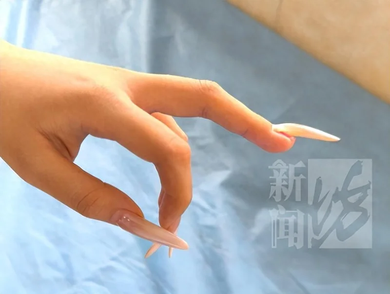 太痛了!女子翻身美甲片连带指甲连根掀起 急诊还打了破伤风