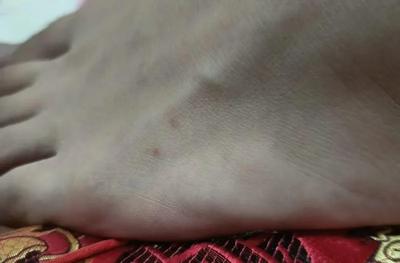 银环蛇闯入家中!男子被咬毫无感觉 救助人员一个举动救回一命