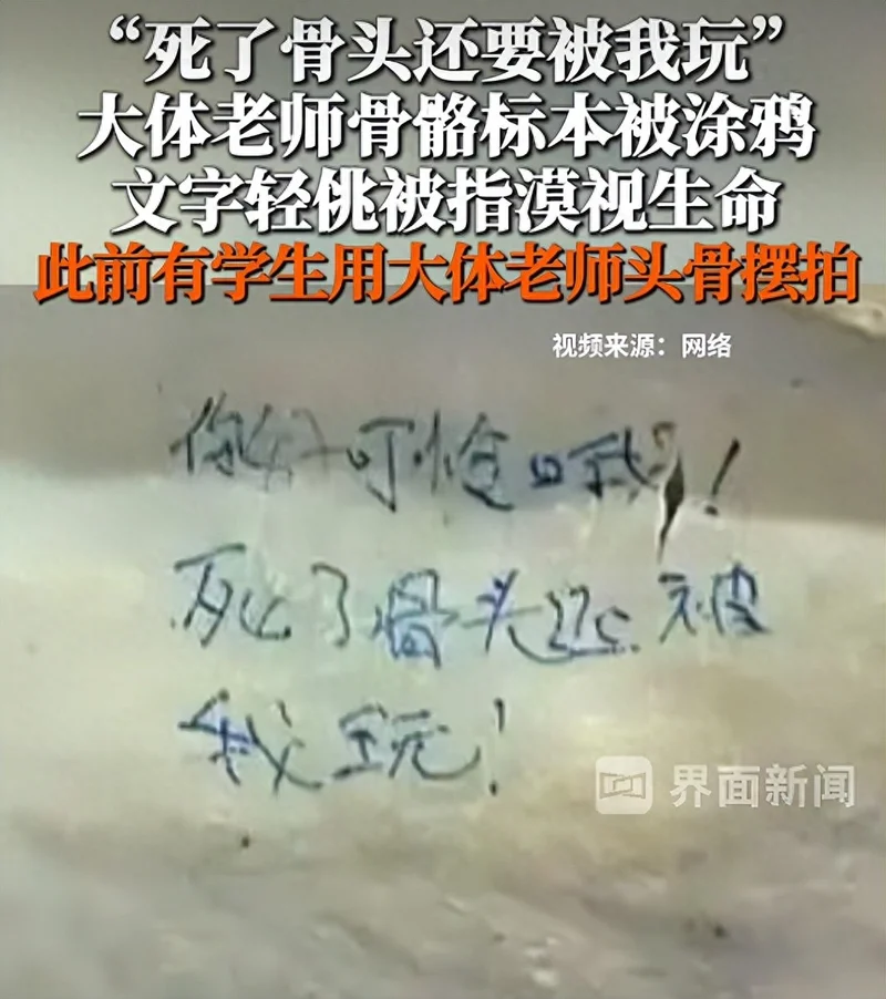 “死了骨头还被我玩”?医科生侮辱大体老师头骨摆拍惹众怒